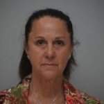 Facelift Before & After Patient #1744