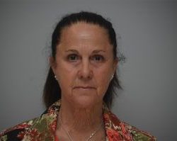 Facelift Before & After Patient #1744