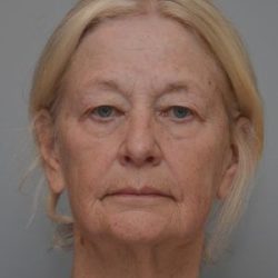 Facetite Before & After Patient #1777