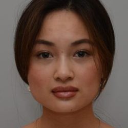 Non-Surgical Rhinoplasty Before & After Patient #2247