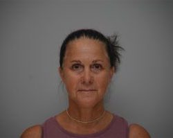 Facelift Before & After Patient #1744