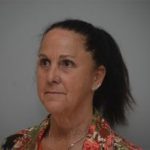 Facelift Before & After Patient #1744