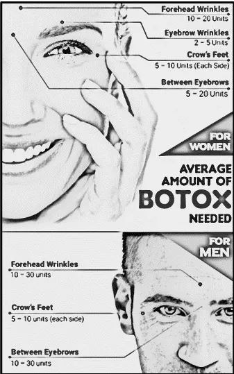 Botox Boston, MA