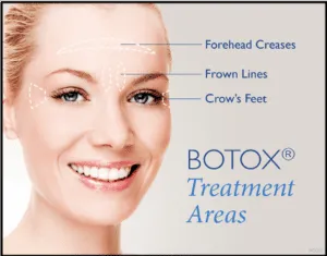 Botox Boston, MA