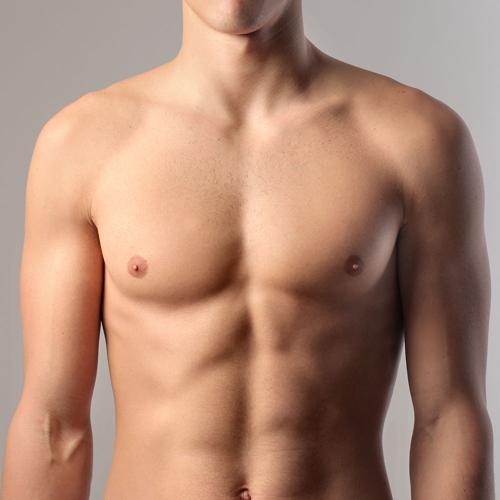 Gynecomastia