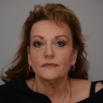 Facelift Before & After Patient #3187