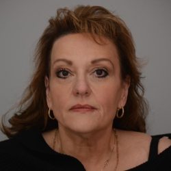 Facelift Before & After Patient #3187