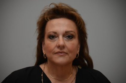 Facelift Before & After Patient #3187