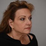 Facelift Before & After Patient #3187
