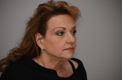 Facelift Before & After Patient #3187