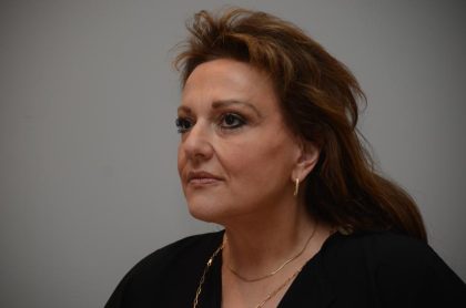 Facelift Before & After Patient #3187