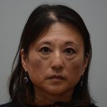 Blepharoplasty Before & After Patient #3421