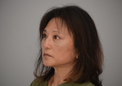 Blepharoplasty Before & After Patient #3421