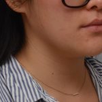 Neck Liposuction Before & After Patient #3467