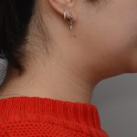 Neck Liposuction Before & After Patient #3656